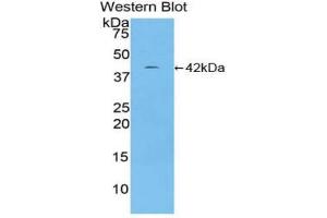 Western blot analysis of the recombinant protein. (Ceruloplasmin Antikörper  (AA 729-1061))