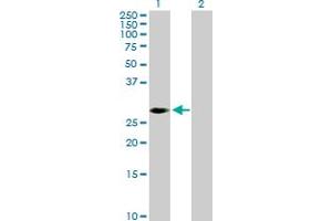 Western Blot analysis of PRKAB2 expression in transfected 293T cell line by PRKAB2 MaxPab polyclonal antibody. (PRKAB2 Antikörper  (AA 1-272))