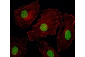 Fluorescent image of HUVEC cells stained with ISL2 antibody. (ISL2 Antikörper  (AA 1-30))