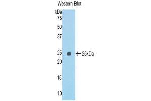 Western Blotting (WB) image for anti-Epithelial Cell Transforming Sequence 2 Oncogene (ECT2) (AA 453-647) antibody (ABIN1858683) (ECT2 Antikörper  (AA 453-647))