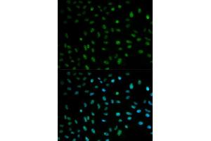 Immunofluorescence analysis of MCF7 cell using ELAVL1 antibody. (ELAVL1 Antikörper  (AA 1-326))