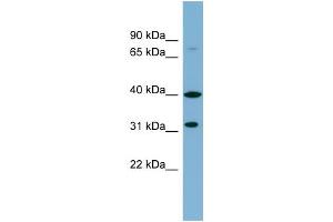 WB Suggested Anti-C9orf4 Antibody Titration:  0. (Ferric-Chelate Reductase 1 Like (FRRS1L) (Middle Region) Antikörper)