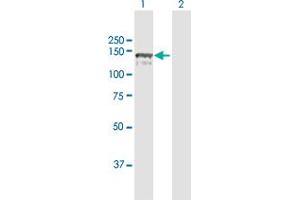 Western Blot analysis of CC2D1A expression in transfected 293T cell line by CC2D1A MaxPab polyclonal antibody. (CC2D1A Antikörper  (AA 1-951))