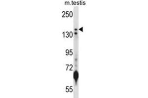 Western Blotting (WB) image for anti-Lysine (K)-Specific Demethylase 5B (KDM5B) antibody (ABIN2998014) (KDM5B Antikörper)