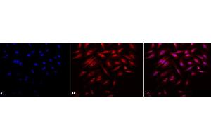 Immunocytochemistry/Immunofluorescence analysis using Rabbit Anti-Rab4 Polyclonal Antibody (ABIN361840 and ABIN361841). (Rab4 Antikörper  (C-Term))