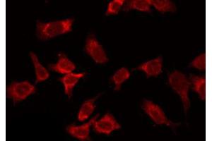 ABIN6266872 staining HepG2 by IF/ICC. (COL14A1 Antikörper  (C-Term))
