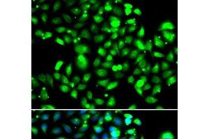 Immunofluorescence analysis of U2OS cells using GBP1 Polyclonal Antibody (GBP1 Antikörper)