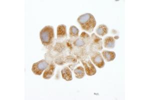 Immunohistochemistry (IHC) image for anti-DEAD (Asp-Glu-Ala-Asp) Box Polypeptide 3, X-Linked (DDX3X) (AA 1-50) antibody (ABIN7448520) (DDX3X Antikörper  (AA 1-50))