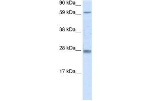 WB Suggested Anti-RHOX11 Antibody Titration:  0. (RHOX11 Antikörper  (N-Term))