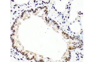 Immunohistochemistry of paraffin-embedded Rat lung using TET2 Polyclonal Antibody at dilution of 1:100 (40x lens).