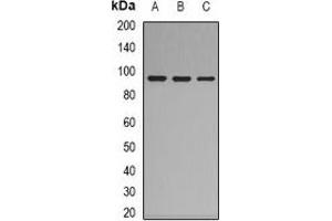 Western blot analysis of Complement C7 expression in HepG2 (A), K562 (B), mouse lung (C) whole cell lysates.