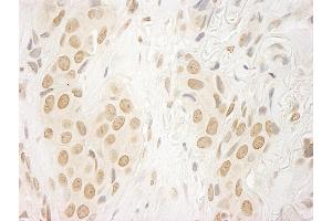 Immunohistochemistry (IHC) image for anti-Bromodomain PHD Finger Transcription Factor (BPTF) (AA 1350-1400) antibody (ABIN7448561)
