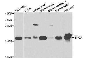 Western blot analysis of extracts of various cell lines, using SNCA antibody. (SNCA Antikörper)