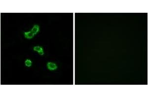 Immunofluorescence analysis of MCF7 cells, using CA5B Antibody. (CA5B Antikörper  (AA 241-290))