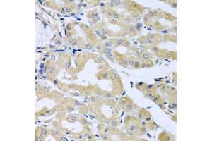 Immunohistochemistry of paraffin-embedded human stomach using HS1BP3 antibody at dilution of 1:100 (x40 lens). (HS1BP3 Antikörper)