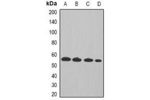 Western blot analysis of Cyclin A2 expression in Hela (A), MCF7 (B), mouse spleen (C), rat thymus (D) whole cell lysates. (Cyclin A Antikörper)