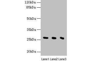 Western blot All lanes: Nqo2 antibody at 8 μg/mL Lane 1: Rat heart tissue Lane 2: Mouse liver tissue Lane 3: Mouse kidney tissue Secondary Goat polyclonal to rabbit IgG at 1/10000 dilution Predicted band size: 27 kDa Observed band size: 27 kDa (NQO2 Antikörper  (AA 1-231))