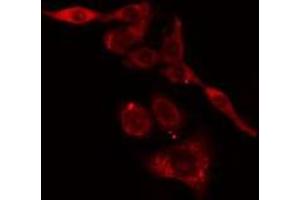 ABIN6275778 staining LOVO cells by IF/ICC. (KRT37,38 Antikörper)