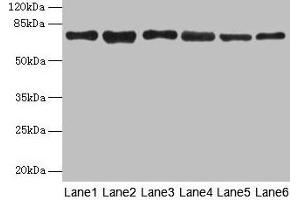 Western blot All lanes: TMCC1 antibody at 1 μg/mL Lane 1: MCF-7 whole cell lysate Lane 2: Mouse liver tissue Lane 3: Mouse kidney tissue Lane 4: HL60 whole cell lysate Lane 5: K562 whole cell lysate Lane 6: U937 whole cell lysate Secondary Goat polyclonal to rabbit IgG at 1/10000 dilution Predicted band size: 73, 54 kDa Observed band size: 73 kDa (TMCC1 Antikörper  (AA 51-300))