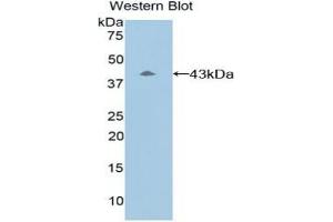 Detection of Recombinant C8b, Mouse using Polyclonal Antibody to Complement Component 8b (C8b) (C8B Antikörper  (AA 161-503))