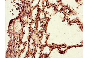 Immunohistochemistry of paraffin-embedded human lung tissue using ABIN7163786 at dilution of 1:100 (PAIP2 Antikörper  (AA 1-127))