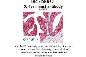 Image no. 2 for anti-Dehydrogenase/reductase (SDR Family) Member 7 (DHRS7) (C-Term) antibody (ABIN1733630) (DHRS7 Antikörper  (C-Term))