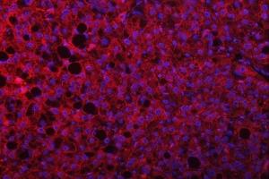 IF analysis of SEPTIN9 using anti-SEPTIN9 antibody (ABIN7600104). (Septin 9 Antikörper  (AA 15-282))