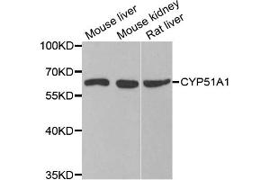 Western blot analysis of extracts of various cell lines, using CYP51A1 antibody (ABIN5973683) at 1/1000 dilution. (CYP51A1 Antikörper)
