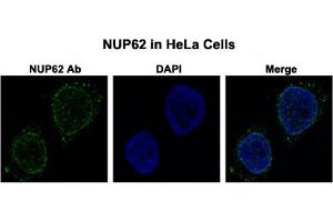 Immunofluorescent staining of HeLa cells with NUP62 polyclonal antibody  at 0. (NUP62 Antikörper  (N-Term))