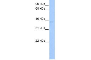 WB Suggested Anti-RPL3 Antibody Titration:  0. (RPL3 Antikörper  (C-Term))