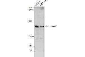 WB Image TOPBP1 antibody detects TOPBP1 protein by western blot analysis.