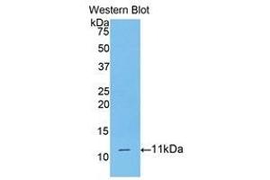 Western Blotting (WB) image for anti-CD3d Molecule, delta (CD3-TCR Complex) (CD3D) (AA 22-103) antibody (ABIN3205926) (CD3D Antikörper  (AA 22-103))