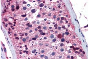 Human Testis: Formalin-Fixed, Paraffin-Embedded (FFPE) (FOXO1 Antikörper  (AA 373-422))