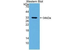 Detection of Recombinant ANXA5, Human using Monoclonal Antibody to Annexin V (ANXA5) (Annexin V Antikörper  (AA 1-320))