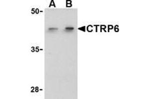 Western blot analysis of CTRP6 in HeLa cell lysate with AP30256PU-N CTRP6 antibody at (A) 1 and (B) 2 μg/ml.