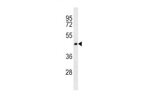 CWC27 Antibody (C-term) (ABIN1881243 and ABIN2843291) western blot analysis in MDA-M cell line lysates (35 μg/lane). (Cwc27 Antikörper  (C-Term))