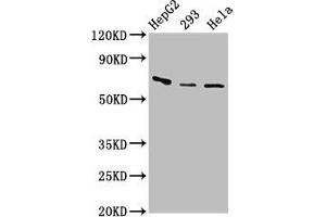Western Blot Positive WB detected in: HepG2 whole cell lysate, 293 whole cell lysate, Hela whole cell lysate All lanes: CFI antibody at 3. (Complement Factor I Antikörper  (AA 239-316))