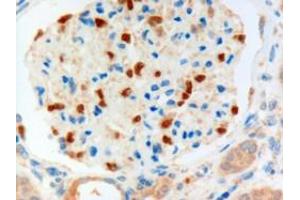 Immunohistochemistry (IHC) image for anti-Forkhead Box C1 (FOXC1) (C-Term) antibody (ABIN185028)