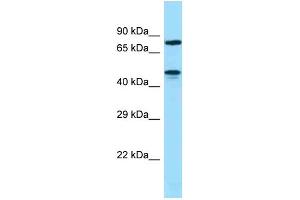 WB Suggested Anti-ZNF311 Antibody Titration: 1.