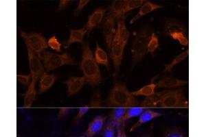 Immunofluorescence analysis of NIH-3T3 cells using VPS36 Polyclonal Antibody at dilution of 1:100 (40x lens). (VPS36 Antikörper)