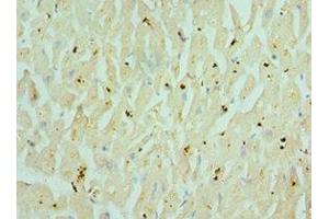 Immunohistochemistry of paraffin-embedded human heart tissue using ABIN7160351 at dilution of 1:100 (CHRM3 Antikörper  (AA 270-470))