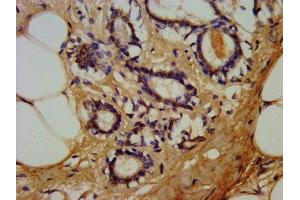 Immunohistochemistry (IHC) image for anti-Lymphotoxin beta Receptor (TNFR Superfamily, Member 3) (LTBR) (AA 31-224) antibody (ABIN7173883)