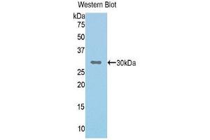 Western Blotting (WB) image for anti-Complement Factor I (CFI) (AA 340-583) antibody (ABIN3205710) (Complement Factor I Antikörper  (AA 340-583))