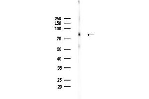 anti-RALBP1 Associated Eps Domain Containing 1 (REPS1) (pSer709) antibody
