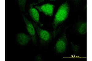 Immunofluorescence of monoclonal antibody to HIPK1 on HeLa cell. (HIPK1 Antikörper  (AA 330-430))