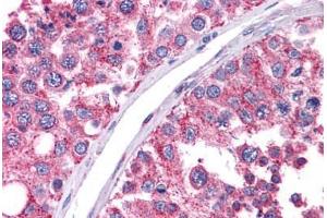 Immunohistochemistry (Formalin-fixed Paraffin-embedded Sections) (IHC (fp)) image for anti-Wilms Tumor 1 (WT1) (C-Term) antibody (ABIN604665)