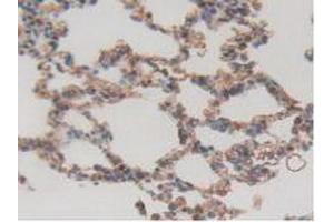IHC-P analysis of Rat Lung Tissue, with DAB staining. (ITGAD Antikörper  (AA 879-1099))