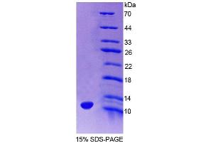 SDS-PAGE analysis of Mouse HOP Protein.