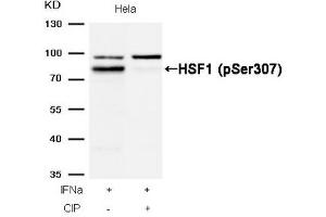 Western Blotting (WB) image for anti-Heat Shock Factor Protein 1 (HSF1) (pSer307) antibody (ABIN7138540)