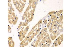 Immunohistochemistry of paraffin-embedded Mouse heart using KYNU Polyclonal Antibody at dilution of 1:100 (40x lens). (KYNU Antikörper)